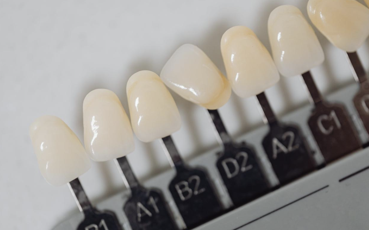 How To Get Help At Your Local Walk-In Dentists?_3