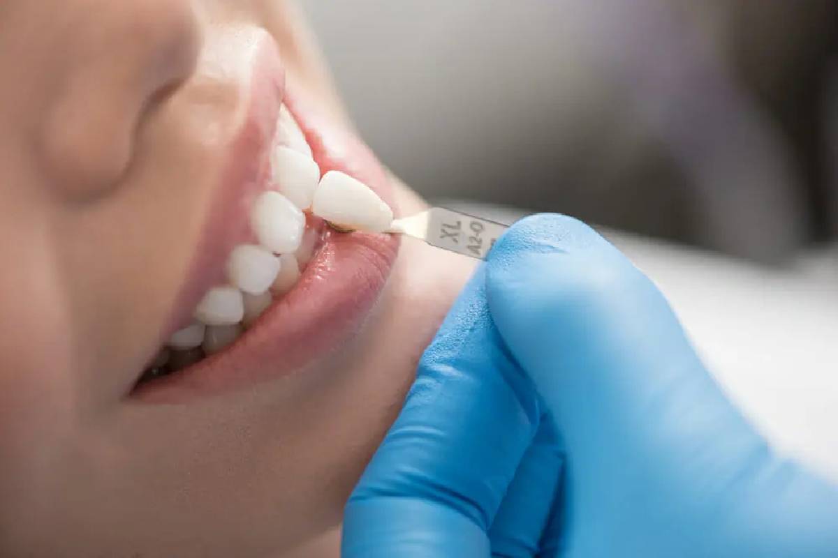 Why Avoid Cheap Dental Clinics?_4